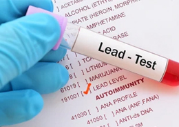 Lead Testing